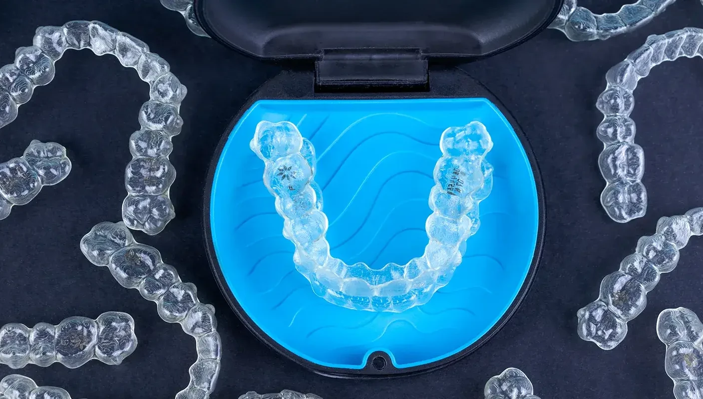Transparente Zahnspange Aligner in blauem Etui, Invisalign Schiene nah.